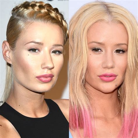 Did Iggy Azalea Get A Nose Job And Chin Implant E Online
