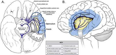 Mri Venous Architecture Of Insula Journal Of The Neurological Sciences