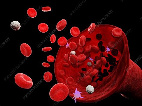 Blood Vessel Illustration Stock Image F0256106 Science Photo