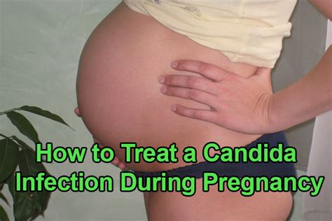 How To Treat A Candida Infection During Pregnancy Today Health Issues