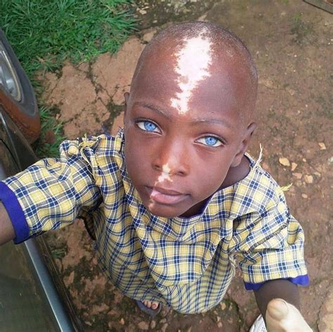 Nigerian Boy Pictured With Natural Beautiful Blue Eyes Photo