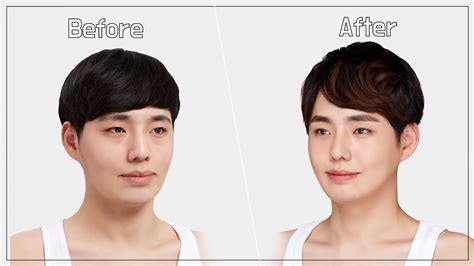 male plastic surgery review before and after youtube