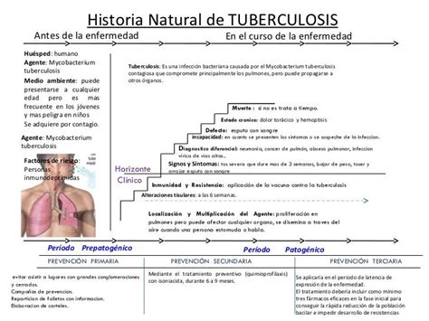 Historia Natural De Tuberculosis