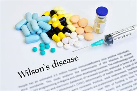 Choroba Wilsona Przyczyny Objawy Diagnostyka Leczenie