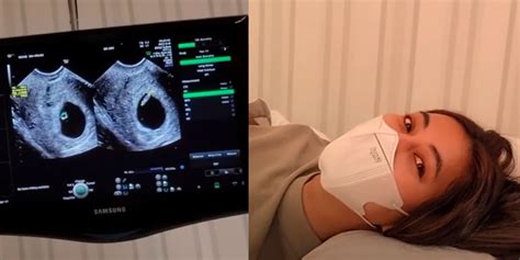 Kondisi Kehamilan Paula Verhoeven, Janin Sehat Berusia 6 Minggu