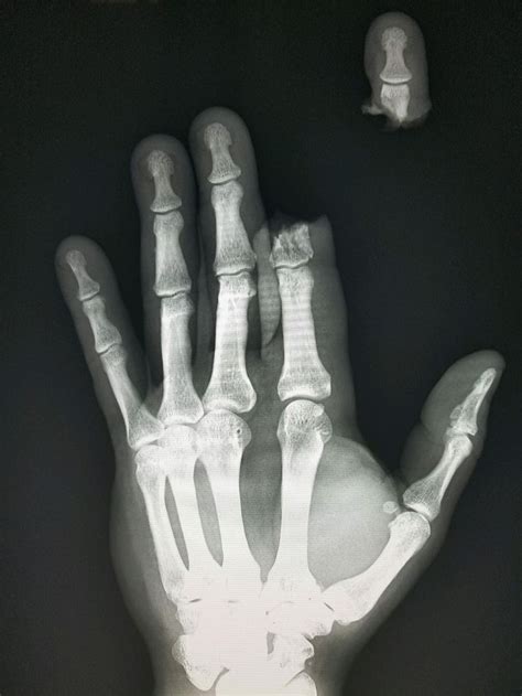 Pin On X Rays