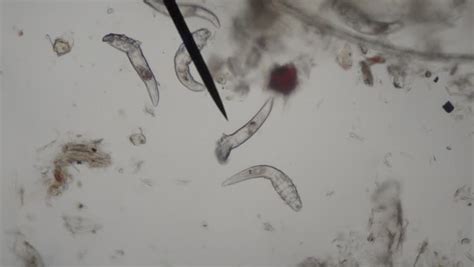 Demodectic Mange Mites Demodex Demodex Canis Seen Under Microscope