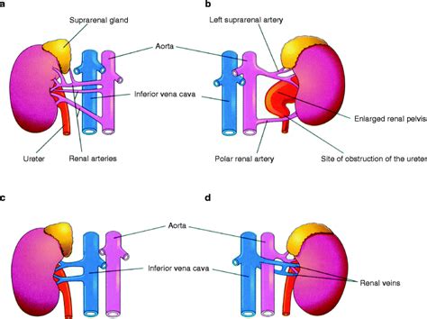 Embryology Of The Kidney Springerlink