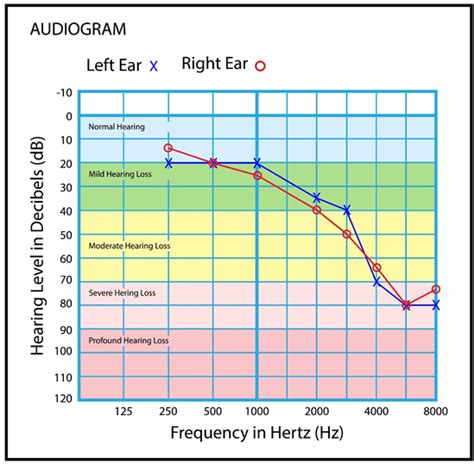 What Is An Audiogram And How Do You Read It