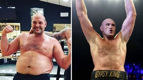 The Bald Icons Who Is Tyson Fury The Bald Brothers