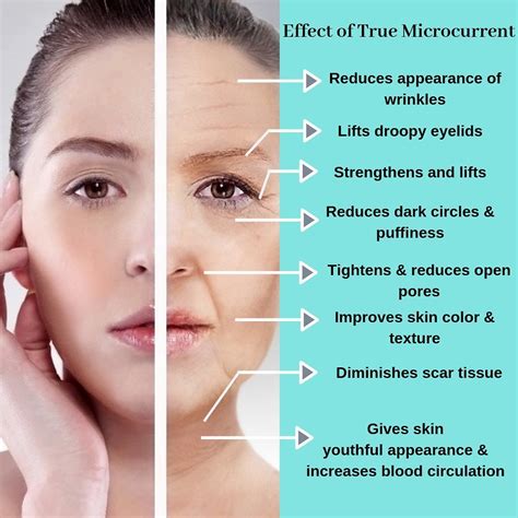 Did You Know That Microcurrent Therapy Helps To ⠀⠀ Tighten Facial