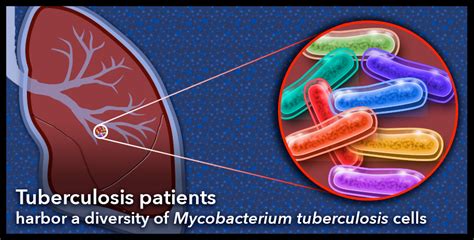 Developing Drug Resistance May Be A Matter Of Diversity For Tuberculosis