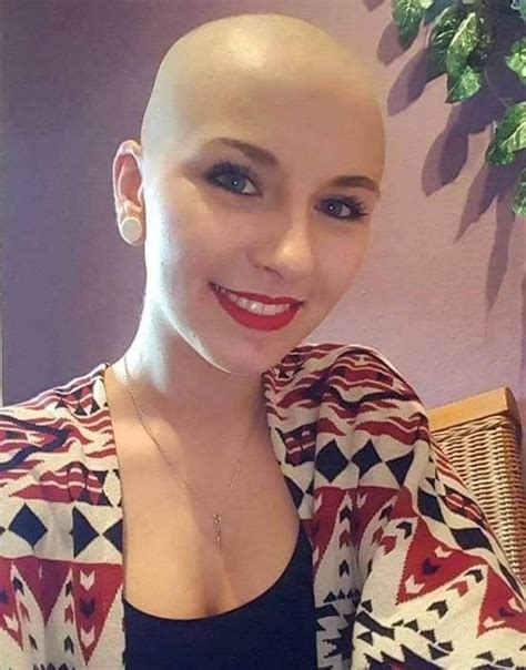We did not find results for: 13226981_485003825039470_7896801915983786042_n | Bald ...
