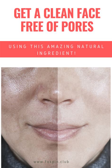How To Clean Face Free Of Pores Using This Amazing Natural Ingredient