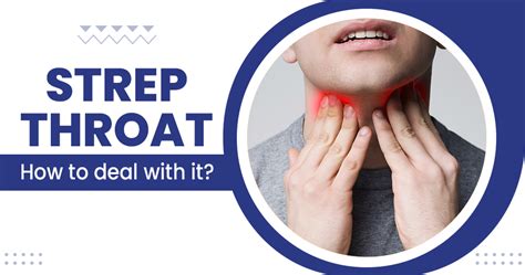 Strep Throat Causes Symptoms Treatment Star Health