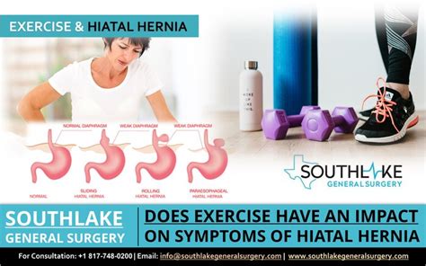 does exercise have any impact on symptoms of hiatal hernia southlake general surgery