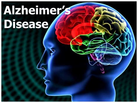 Finally Alzheimers Drug Gets Approval In The Us