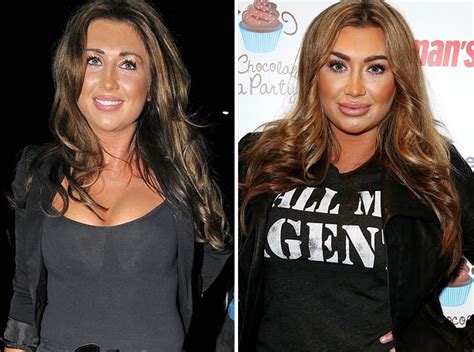 Celebrity Plastic Surgery Before And After Photos Better Or Worse