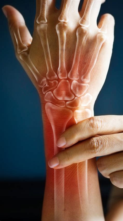 Hand And Wrist Pain Symptoms And Causes West Coast Orthopedics Hot