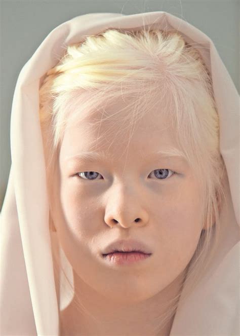Xueli Wil Mod Le Albinos Photos Beaut Beaut Africaine Et Photo Visage