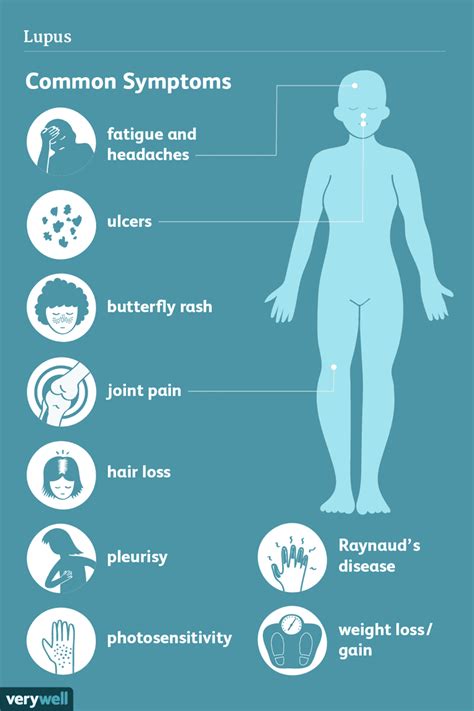 Symptome Von Lupus