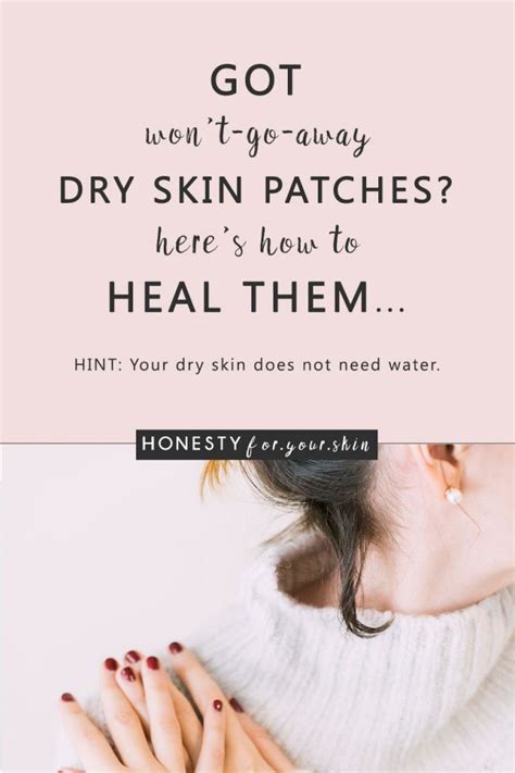 Dry Skin Patches Heres How To Fix Them Honesty For Your Skin