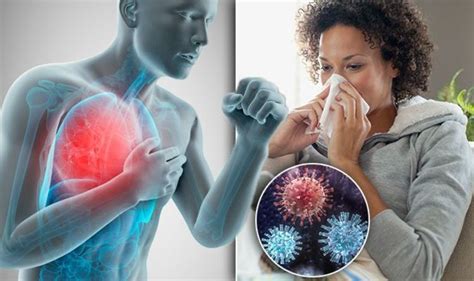 Swine Flu Symptoms Virus Infection Cases In Uk Signs Include Cough