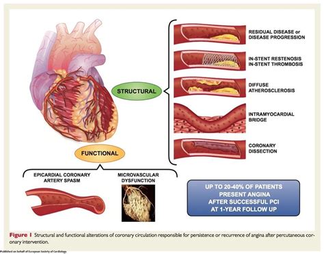 Designed to have a distinct moa. Pin by Andres Sanchez on Cardiology in 2020 (With images ...