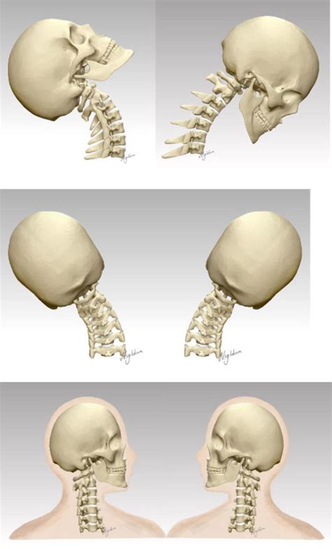 Diagram Cervical Spine