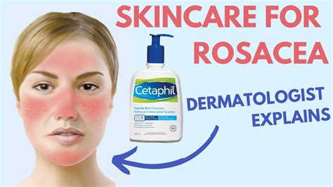 Bereich Störung Kosmisch Cetaphil Rosacea Uk Tinte Glühen Hausieren