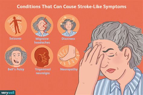 Conditions Pouvant Causer Des Sympt Mes Semblables Ceux D Un Avc Fmedic