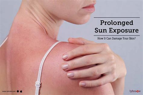 Prolonged Sun Exposure How It Can Damage Your Skin By Dr