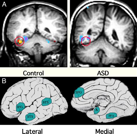 The Developmental Neurobiology Of Autism Spectrum Disorder Journal Of Neuroscience
