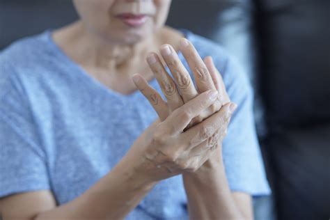 Osteoarthritis Of The Hands What Is It By Amy Eckert Occupational