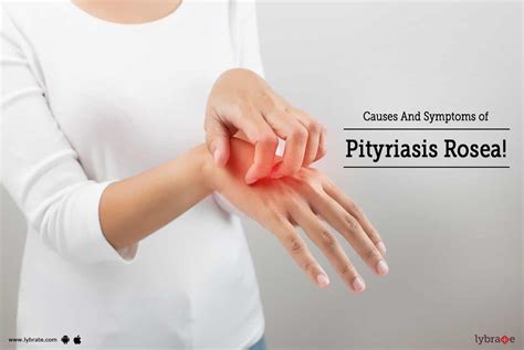 Causes And Symptoms Of Pityriasis Rosea By Dr Shruti Lybrate