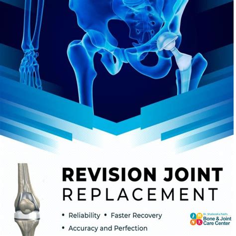 Revision Kneehip Replacement Surgery In Thane And Mulund Mumbai Bone