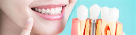 Permanent Tooth Replacement Seabreeze Dental Group