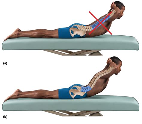 Lumbar Spine Exercises