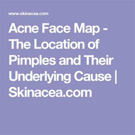 Acne Face Map The Location Of Pimples And Their Underlying Cause