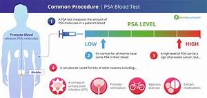 How To Lower Your Psa Level Safely And Effectively