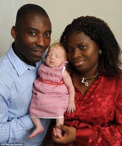 Several tufts of black and blonde hair. In London 2010, a Nigerian couple gave birth to a blue ...