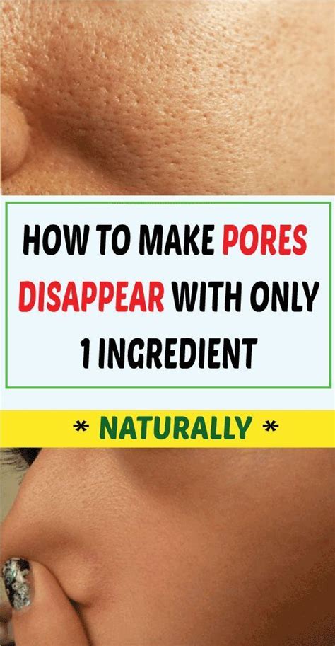 How To Make Pores Disappear With Only 1 Ingredient Naturally Smaller