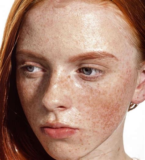 Freckles On Face Pictures 63 Photos And Images