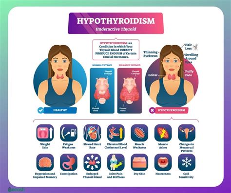HYPOTHYROIDISM UNDERACTIVE THYROID Symptoms Causes Risk Groups Natural Treatment And