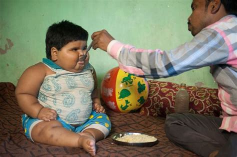 Worlds Fattest Toddler 18 Month Old Girl Baffles Doctors With Rapid