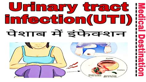 Urinary Tract Infection Uti In Hindi Symptoms Causes And Treatment Medical Destination