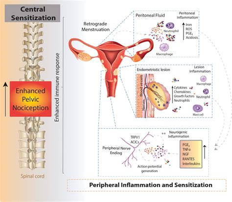 Frontiers Pain In Endometriosis