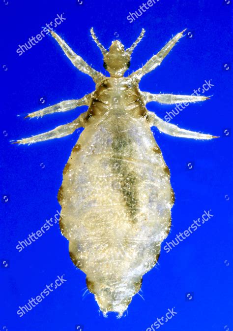 Body Louse Editorial Stock Photo Stock Image Shutterstock