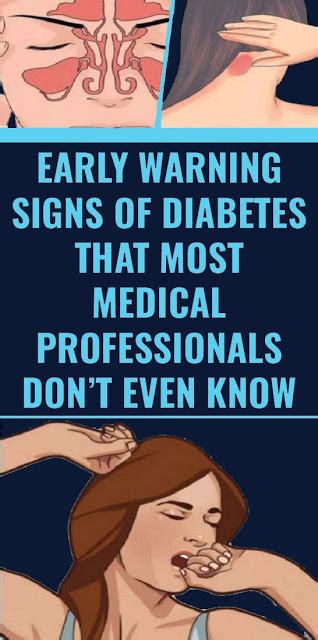 Early Warning Signs Of Diabetes That Most Medical Professionals Dont