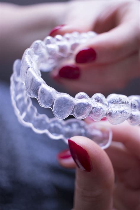Uneven or advanced tooth wear on specific teeth, due to overuse or abnormal pressure Can Invisalign Fix My Overbite? | Bracesetters | Learn ...